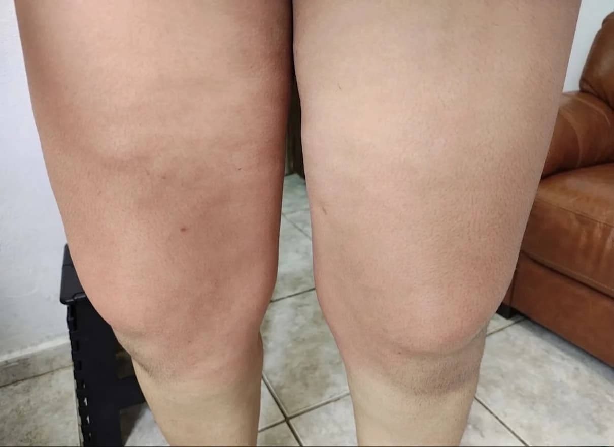 Comparação real lado a lado da aparência das pernas